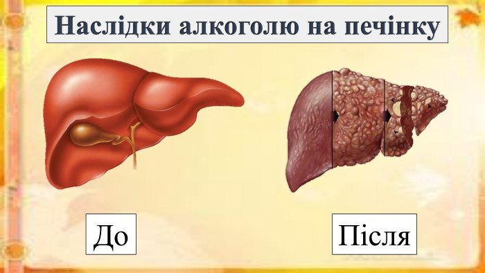 Алкоголь руйнує печінку